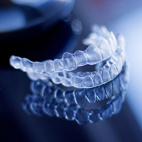 benefits of Invisalign Ottawa